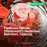 Pankreatit türleri nelerdir? Akut ve kronik farklarıyla birlikte