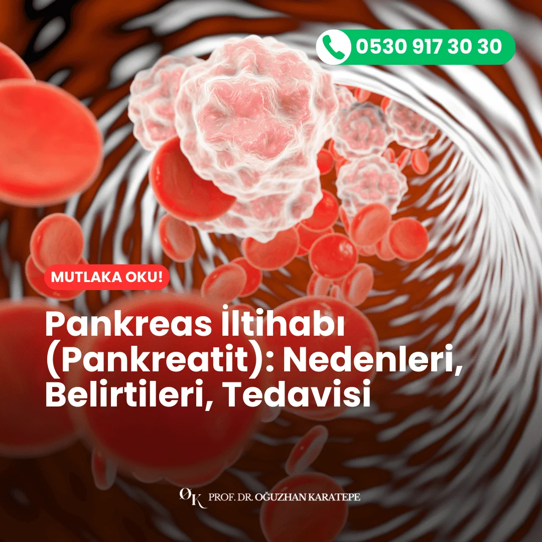 Pankreatit türleri nelerdir? Akut ve kronik farklarıyla birlikte