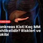 Pankreas Kisti Kaç MM Tehlikelidir? Ne yapmalıyım