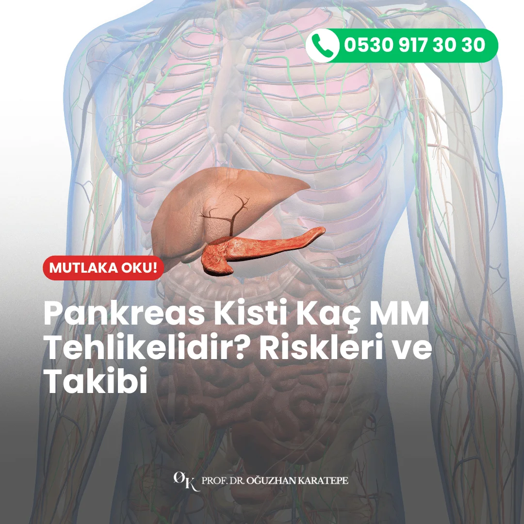 Pankreas Kisti Kaç MM Tehlikelidir?