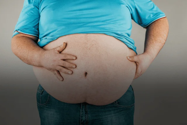 Pankreas kanserinin nedenleri arasında obezite faktörü