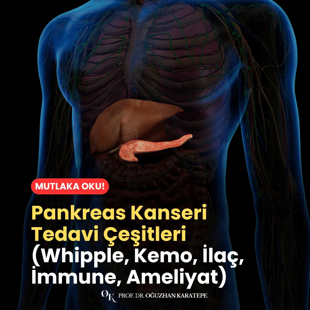 Pankreas Kanseri Tedavi Çeşitleri